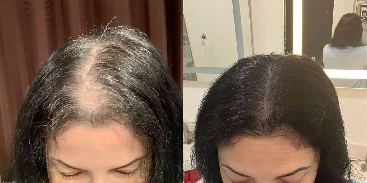 tratamiento para recuperar el pelo spa de lujo